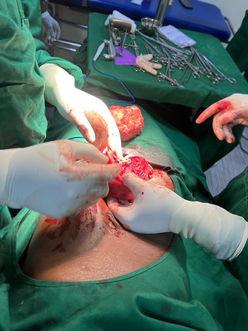 CHIRURGIE A LA SENTINELLE